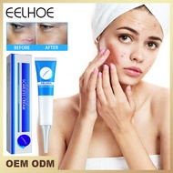 EELHOE Facial restoration Cream Scar Removing Cream for Skin Treatment, Scar Desalination, Surgical Scar Smoothing, and Skin Repair Facial restoration Cream