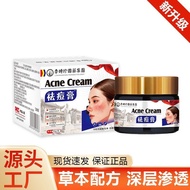 Acne Removal Cream Acne Removal Cream Repair Acne Marks Acne Acne Removal Cream Acne Cream Closed Oi