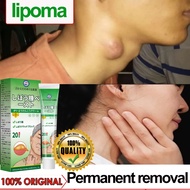 Lipoma cream Lipoma removal cream 20g cellulite remover Single, multiple, systemic sebaceous cyst li