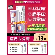 Vitamin a Acid Cream 100% Medical Warts Removal Ordinary Warts Dedicated Ointment Filamental Warts R