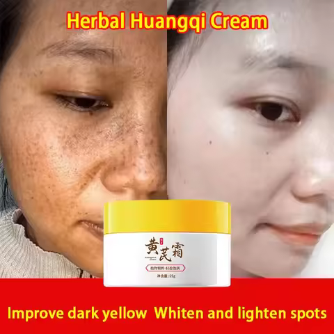 Astragalus Cream Brightening Face Care Moisturizing Cream Freckles Cream Face Dark Spots Remover Rep