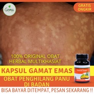 Obat Kapsul Menghilangkan Panu |  100% - Obat Gatal Panu Kudis Kurap - Obat Jamur Panu - Obat Kulit 