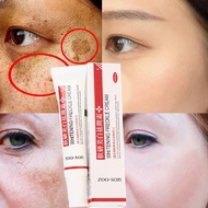 Flechazome | Freckle cream remove skin Melasma acne stain pigment melanin dark spots hot whitening