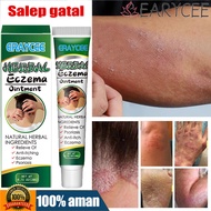 ERAYCEE Obat Herbal Ekszema Salep 20g, detoksifikasi, gatal, psoriasis, Ampuh salep untuk penyembuhk