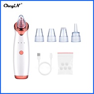 ☇◑ ¤ ◈ Ckeyin Blackhead Remover Electric Vacuum Suction Blackhead Extractor Clean Tool with 4 Probe