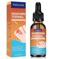 Ingrown Toenail Drop - Ingrown Toenail Pain Reliever and Softener Kit for Men Women Ingrown Toenail 