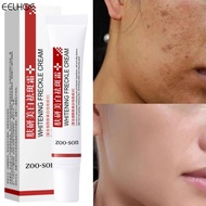 1/2pcs Original Pekas Cream Melasma Remover Cream Collagen Freckle Remover Cream Pantanggal Ng Pekas Cream metro.sg