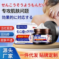 Kurai Tanned Acid Buttocks Cream Soothes Redness Redness Skin Discomfort Itching Skin External Care 