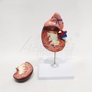 Magnified Kidney Adrenal Gland Model Human Urinary System Anatomy Medical Teaching Tool