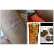 KRIM eczema/ kudis/ panau/kurap
