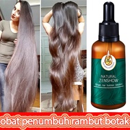 penumbuh rambut - obat rambut rontok parah/penumbuh rambut botak pria/obat penumbuh rambut botak/pen