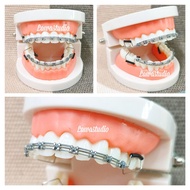 Braces Click Powertrain Design | Fashion Braces Clip | Click Braces Viral
