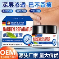 German Fria Scar Cream Fade Burn Burn Scar Scar Cream Scar Generate Scar Smear Cream 26.1.6