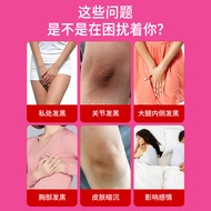 Kyosaka Seika Fening Fade Black Cream Fening Cream Fade Black Private Parts Maintenance Areola Priva