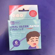 Acumedi oral ulcer patch 6s