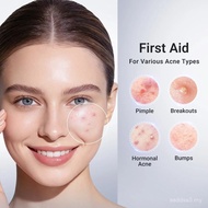 Dr.LeoDryingLotion|PimpleTreatment&BodyAcneTreatment|VisiblyShrinksPimplesin24Hours&HelpsFadeAcneMar