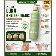 Eczema Cream | Eczema Cream | Eczema Cream | Psoriasis Cream | Itchy Skin Cream | Dry Skin | Steroid