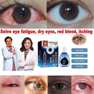 🔥Ready stock🔥eye drop eye drops for dry eyes Refresh Tears 10ml Relieve presbyopia/dry eyes/eye fatigue