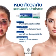 Bruderm cream ครีมลดรอยช้ำ ลดบวมอันดับ 1 ที่มแพทย์ศัลยกรรมเกาหลี