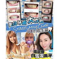 W242.082 [StarSmileClub]美國藍光美白牙齒機|(MRT) - 現貨