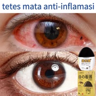 MATA MERAH Eye Drops Cataract Eye Medicine minus Eye Drops Herbal Eye Drops Ma Eye Drops Fat Eyes Dry Eyes Cataract Glaucoma Eye Pain Itching Myopia Red Blood Astigmatism Presbyopia Floaters