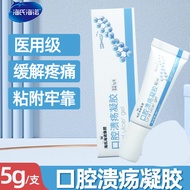 Heines Heines II Medical Oral Ulcers Gel Repairing Tongue Sore Fire Foaming Swelling Pain Creation F