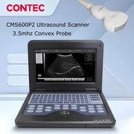 CONTEC CMS600P2 Portable Laptop Machine Digital Ultrasound Scanner 10.1" LCD 3.5Mhz Convex Abdominal