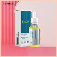 ❡ ◹ ℗ HEMEIEL Sos Pimple Remover/Pimple Marks Acne Spot Treatment/Isotretinoin