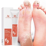 【CW】 Anti Crack Foot Cream Feet Peel Mask Heel Cracked Dry Repair Removal Dead Skin Hand Care For Family