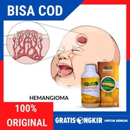 Obat Hemangioma - Obat Benjolan Pada Bayi - Obat Bintik Merah Pada Kulit - Obat Tumor Jinak - Obat K