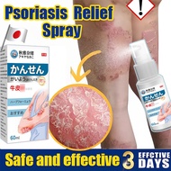 Psoriasis Spray 60ml Eczema anti itch antifungal Spray Japan psoriasis pain relief spray for itchy s