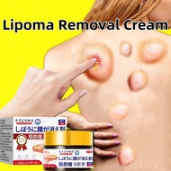 Lipoma Removal Cream Original subcutaneous Lipoma Elimination Benjolan Fat Lump Lipoma Hard Lumps Fa