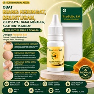 MERAH Medicine for Children's Prickly Heat, Itchy Pimples, Chronic Hives, Itchy Skin, Medicine for R