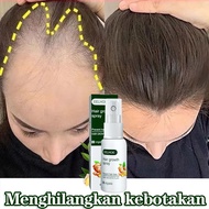 20ml EELHOE Hair Growth Spray Ginger King Serum Anti Botak Rambut Lebat Sehat BErkilau-Penumbuh Ramb