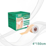 Silicone Scar Sheet Silicone plaster scar remover Scar patch Silicon Keloid Scar Plaster Black scar 