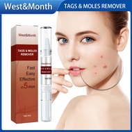 West Month Tags Moles Remover Pen Mole Remover Tags Remover Warts Warts Remover Original Cream Painl