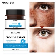 S N ML P Removal Cream Cream F r e c k l a m 3 0g Moisturizing