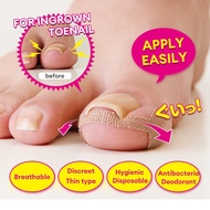AIMEDIA Ingrown Toenail Care Tape