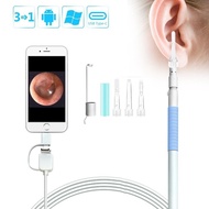 Otoscope &amp; Ear Endoscope