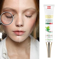 clearance"Spot removing cream,Eye Milia Removal Cream "