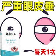 Firm Upper Eyelid Swollen Eye Foam Lift Relax Eye Skin Powerless Sagging Improve Large Small Eyelid 