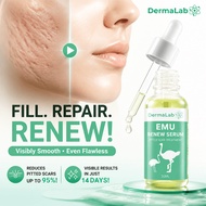 Dermalab Emu Renew Serum 30ml Scar Removal Cream For Acne Scars, Stretch Marks & Surgical Marks Safe