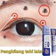 Ubat Buang Kutil ubat ketuat kutil ketuat tahi lalat biji kolestrol skin tag remover Warts removal c