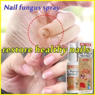 ㍿ ✤ ♟ ️️Bonil Anti Fungal Solution 50ml Nail Repair Nail Fungal Treatment Anti-fungal Care Set Tool