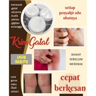 krim gatal/ubat gatal/gatal hilang/kulit sekata/parut hilang/gatal tiada