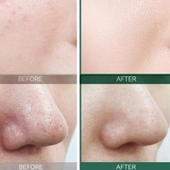 Somebymi - Aha-bha-pha 30 Days Miracle Toner 150ml - Some By Mi Me