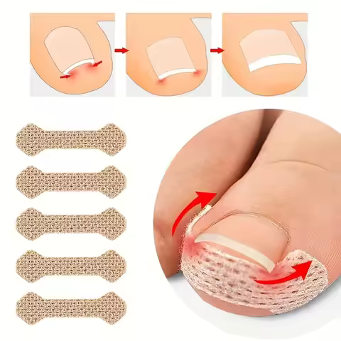 0pcs Toe Patch Set Get Relief from Ingrown Toenails & Enhance Nail Care with Orthopedic Support Nail