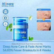 Hipapa Oil Control Face Cream Anti-Acne Centella Soothing Moisturiser for Teens/Adults Sensitive Ski