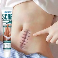 ❈  Scar Removal Cream Fast Remove Scars Effectively Treat Skin Surgery Scars Stretch Marks Acne Pox Prints Burn Scars Facial Gel