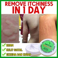 Ubat Gatal Psoriasis Eczema Cream Antifungal Antibacterial Itchy Cream Ubat Gatal Kurap Krim Ezcema 
